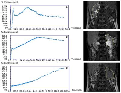 Comparative Study Between Functional MR Urography and Renal Scintigraphy to Evaluate Drainage Curves and Split Renal Function in Children With Congenital Anomalies of Kidney and Urinary Tract (CAKUT)